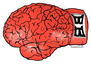 Huni Plans To Spoil Wardley Homecoming With Boxing Brain